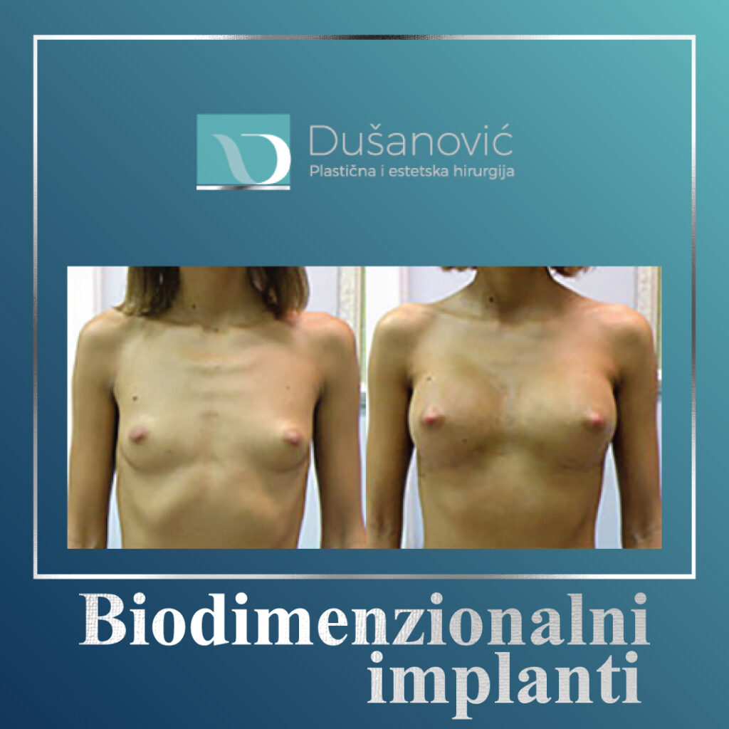 biodimenzionalni implatati