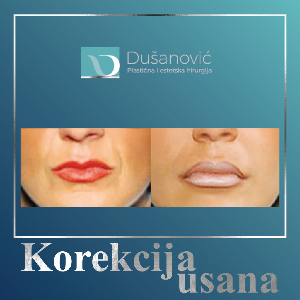 korekcija usana