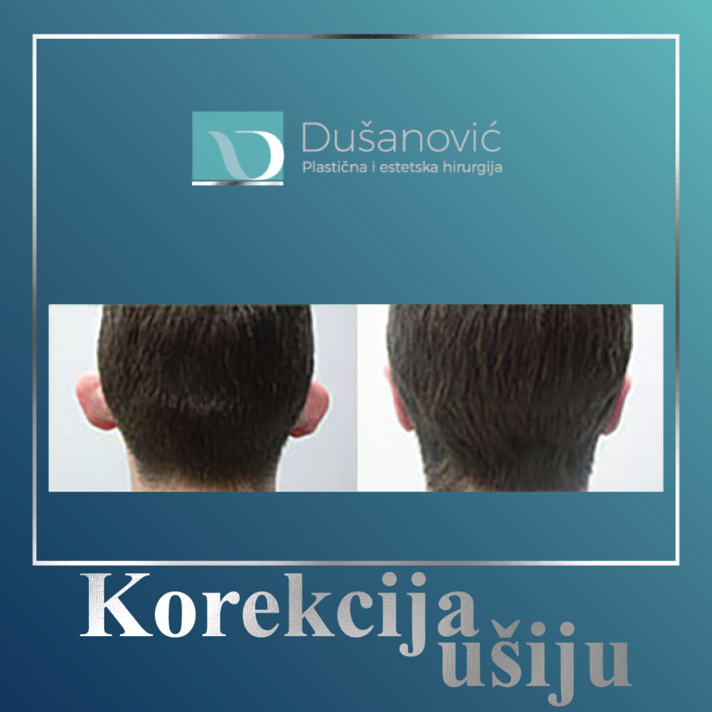 korekcija usiju