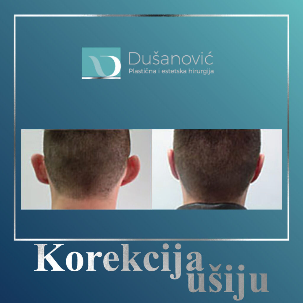 korekcija usiju
