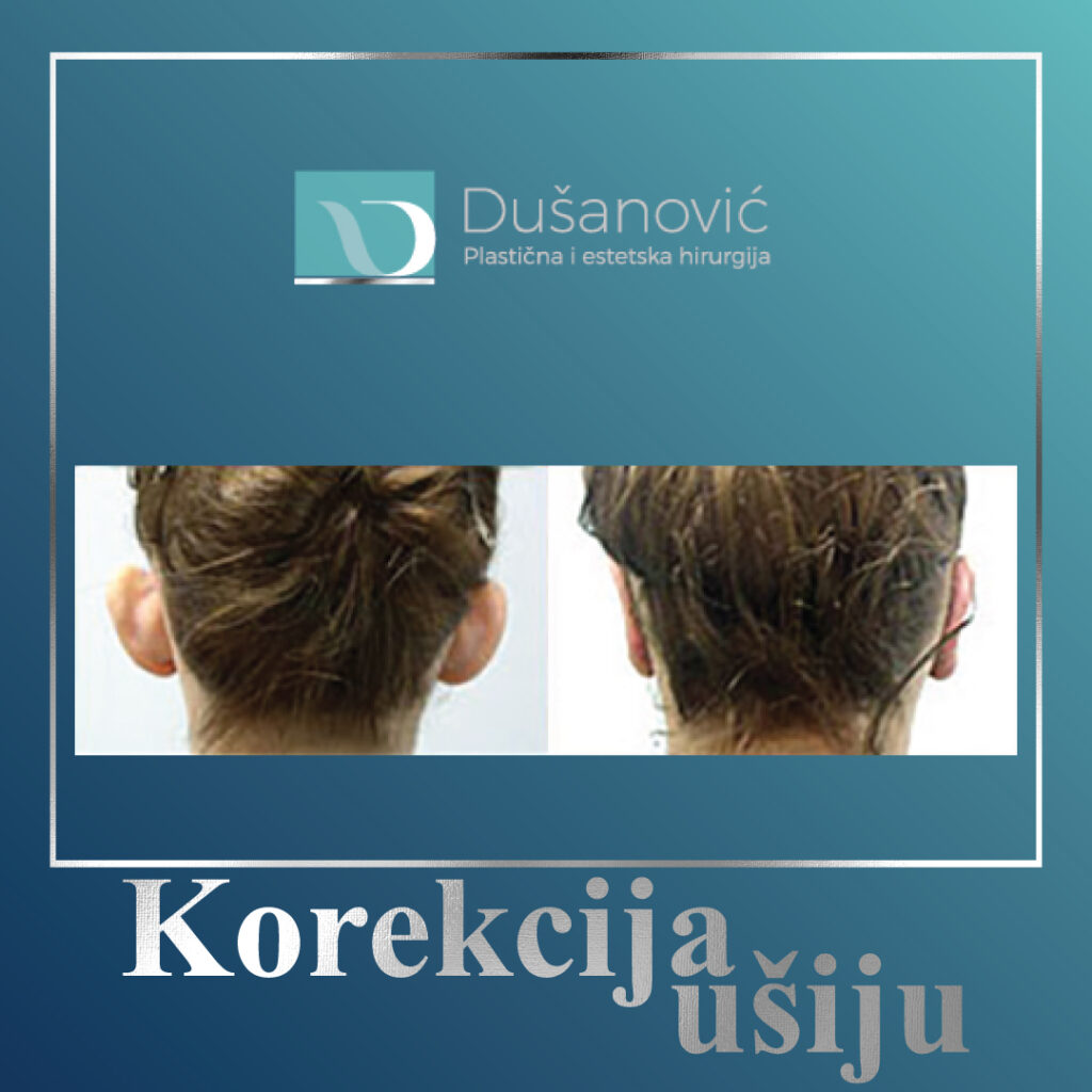 korekcija usiju